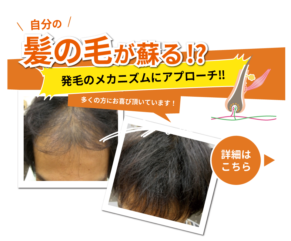 AGA発毛ケア